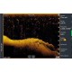 Датчик Lowrance Active Imaging HD 3-in-1 FishReveal