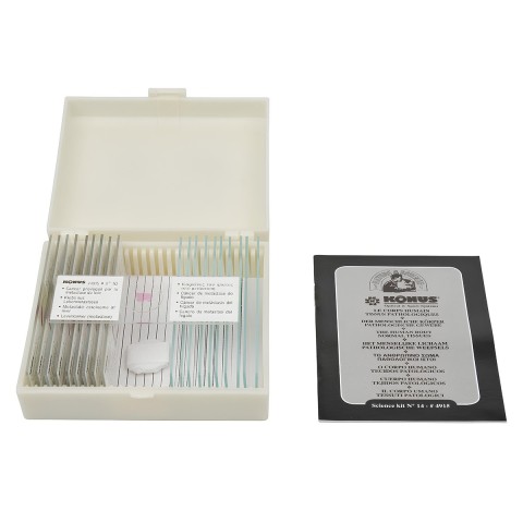 Набір мікропрепаратів KONUS Патологічні тканини людського тіла, частина II (10 шт.)